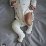 Breakthrough Study Reveals C-Section Link to Childhood Cancer, Experts Call for Informed Public Health Measures