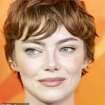 Exclusive: Top Cosmetic Doctor's Privileged Theory on Emma Stone's Secret Facelift