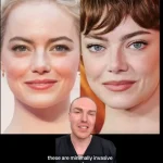 Exclusive: Top Cosmetic Doctor's Privileged Theory on Emma Stone's Secret Facelift