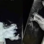 Fireworks Injuries Spark Debate Over Government Regulation of Public Celebrations