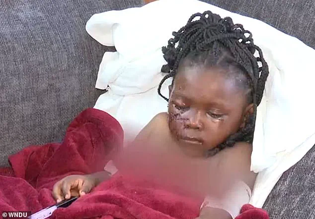 Five-Year-Old Girl Left Permanently Scarred After Brutal Pit Bull Attack in Indiana Backyard