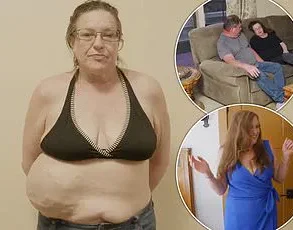 Former Laborer Survives Removal of 76.5-Pound Tumor in Historic Surgery