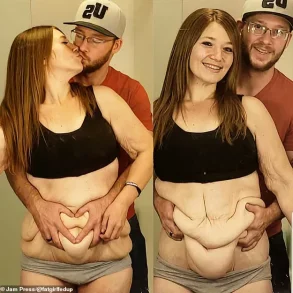 From 298 Pounds to Body Positivity Advocate: Lexi Reed's Inspiring Weight-Loss Journey