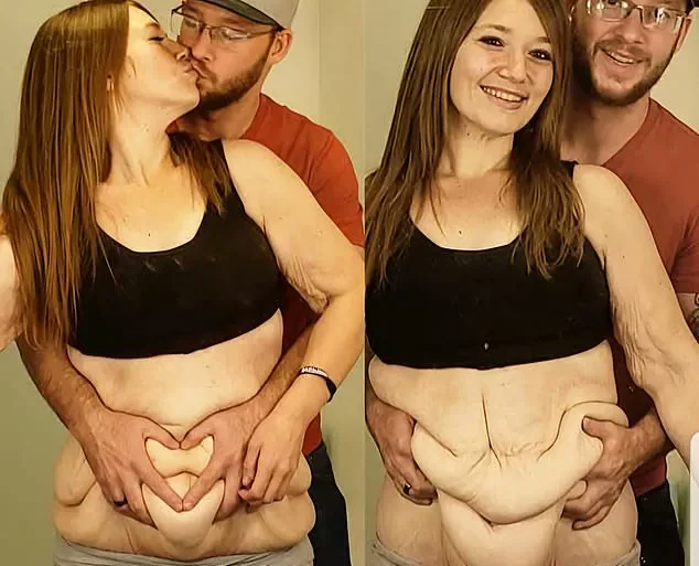 From 298 Pounds to Body Positivity Advocate: Lexi Reed's Inspiring Weight-Loss Journey