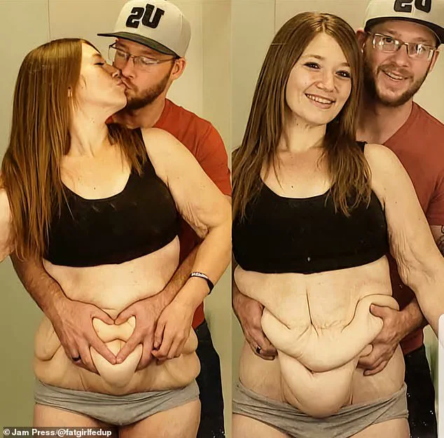 From 298 Pounds to Body Positivity Advocate: Lexi Reed's Inspiring Weight-Loss Journey