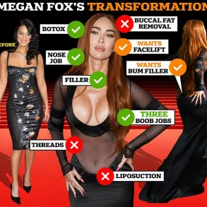 Hollywood Stars Embrace Cosmetic Surgery Openness, But Skepticism Lingers