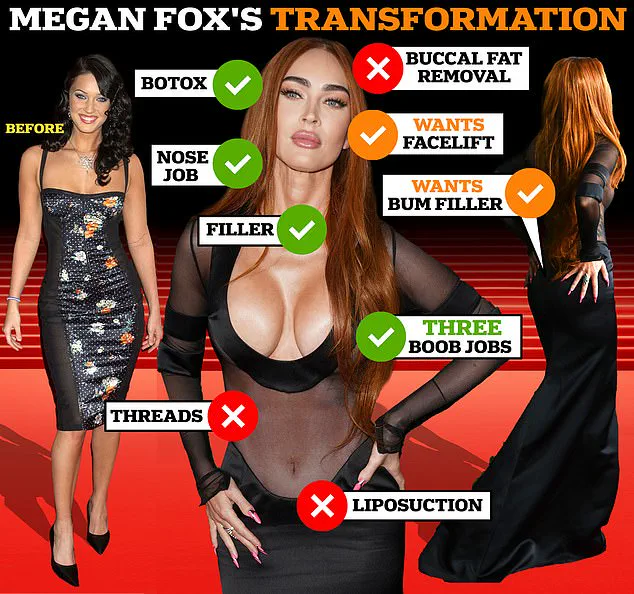 Hollywood Stars Embrace Cosmetic Surgery Openness, But Skepticism Lingers