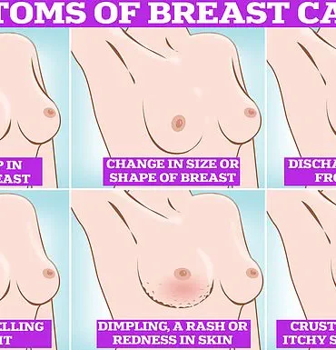 Hormone Replacement Therapy and Breast Cancer Risk: New Study Sparks Debate Over Safety and Regulatory Oversight