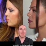 Khloé Kardashian's Sculpted Visage Sparks Speculation About Cosmetic Procedures Amid Public Scrutiny