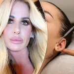 Late-Breaking: Influencer's Breast Augmentation Complications Surface Despite Rapid Recovery Promises