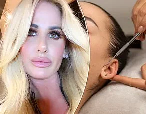 Late-Breaking: Influencer's Breast Augmentation Complications Surface Despite Rapid Recovery Promises