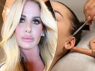 Late-Breaking: Influencer's Breast Augmentation Complications Surface Despite Rapid Recovery Promises