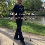Late-Breaking: Leon Otremba's Controversial Leg-Lengthening Surgery Sparks Global Debate as Social Media Videos Reach Tens of Millions