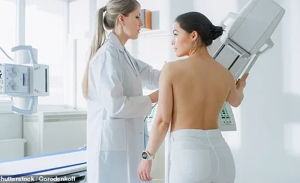 Late-Breaking Study: Breast Cancer Radiotherapy Linked to Lower Alzheimer's Risk, Samsung University Finds
