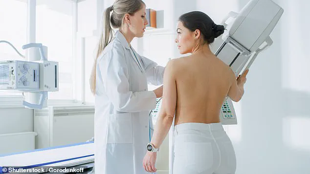 Late-Breaking Study: Breast Cancer Radiotherapy Linked to Lower Alzheimer's Risk, Samsung University Finds