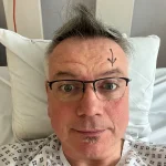 Severe Glaucoma Detected in Man with No Symptoms or Family History