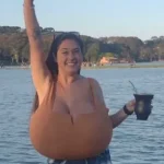 Thaynara Marcondes, 22, Shares Her Journey with Gigantomastia: A Rare Condition That Changed Her Life