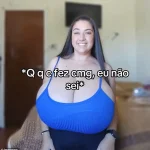 Thaynara Marcondes, 22, Shares Her Journey with Gigantomastia: A Rare Condition That Changed Her Life