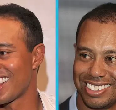 Tiger Woods: Navigating the Challenges of Aging as a Golfing Legend