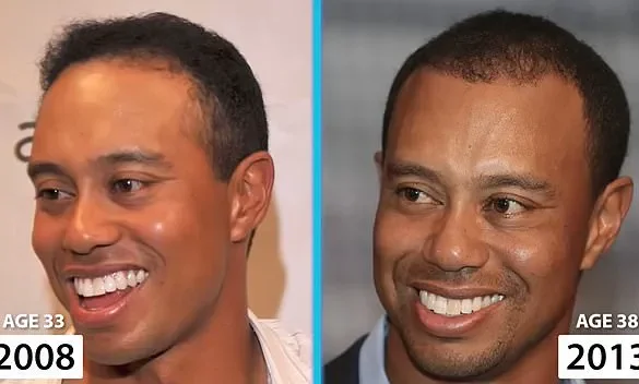 Tiger Woods: Navigating the Challenges of Aging as a Golfing Legend