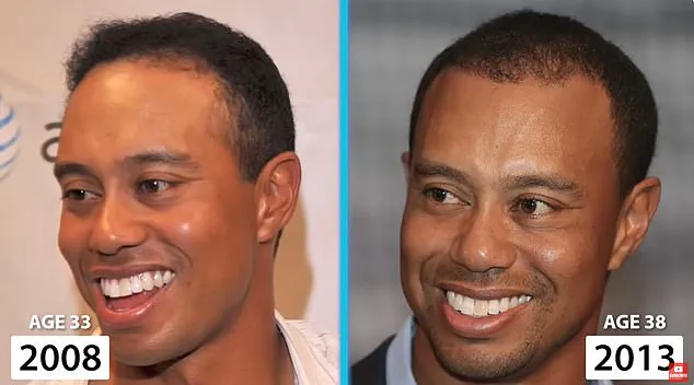 Tiger Woods: Navigating the Challenges of Aging as a Golfing Legend