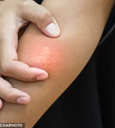 UK Heatwave Crisis: Unprecedented Wasp Behavior Alarms Scientists