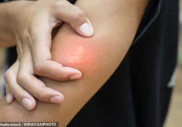UK Heatwave Crisis: Unprecedented Wasp Behavior Alarms Scientists