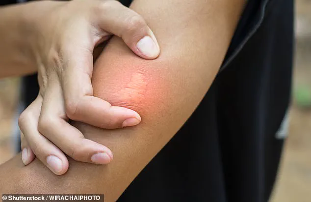 UK Heatwave Crisis: Unprecedented Wasp Behavior Alarms Scientists