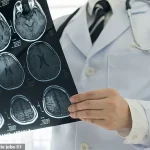 University of Pennsylvania Researchers Identify Brain Structural Variations in Psychopathic Individuals, Shedding Light on Antisocial Behavior Mechanisms