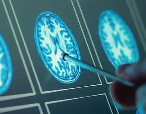Urgent Advisory: New Study Reveals Organ Health's Critical Role in Preventing Alzheimer’s, Heart Failure, and COPD