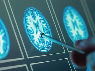 Urgent Advisory: New Study Reveals Organ Health's Critical Role in Preventing Alzheimer’s, Heart Failure, and COPD
