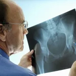 Urgent Warning: NHS Doctors Accuse Government of Failing to Expand Osteoporosis Clinics, Risking Thousands of Lives and Deepening Healthcare Inequality