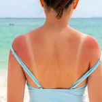 ''UV exposure is a health risk, not a wellness trend'' warns dermatologist as online influencers promote unfiltered sunbathing despite medical consensus