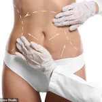Barbie Botox Trend Surges as Women Seek Slimmer Necklines and Shoulders, Sparking Medical Concerns