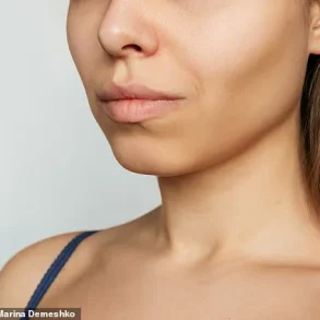 Barbie Botox Trend Surges as Women Seek Slimmer Necklines and Shoulders, Sparking Medical Concerns