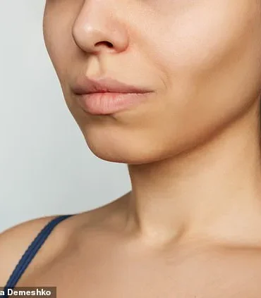 Barbie Botox Trend Surges as Women Seek Slimmer Necklines and Shoulders, Sparking Medical Concerns