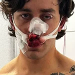 Breaking: NYC Paramedic Sustains Severe Injuries After Heroic Stand Against Knife Attack in Dresden, Germany
