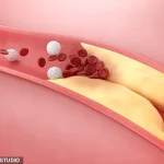 Challenging Conventional Wisdom: Australian Cardiologist Dr. Ross Walker and Professor Bart Kay Spark Debate on Cholesterol's Role in Heart Disease