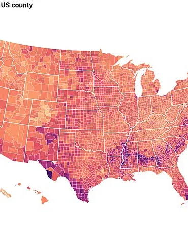 Down Syndrome Linked to Higher Risk of Alzheimer's Disease, Experts Warn