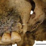 Exclusive 3D Reconstructions Reveal the Mysterious Deaths of Stone Age Sisters in a Czech Republic Mine Shaft