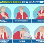 Exclusive Insights: New Brain Cancer Treatment Breakthrough Hints at Limited Access to Groundbreaking Research