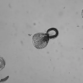 Health Officials Urge Caution Over Rare Brain Infection Linked to Raccoon Feces, CDC Report Highlights Risks
