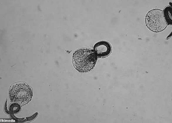 Health Officials Urge Caution Over Rare Brain Infection Linked to Raccoon Feces, CDC Report Highlights Risks