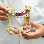 Late-Breaking Study: Yogurt and Hot Springs May Unlock Cognitive Benefits and Lower Colon Cancer Risk