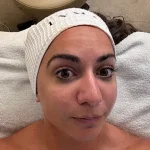LYMA Lift: The Futuristic Facial Favored by Celebrities for Youthful Skin