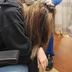 North Carolina teen's hair dye attempt results in scalp burn, leaving giant hole