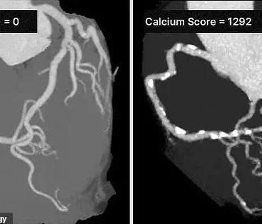 Post-Menopausal Women and Heart Health: Understanding Risk Factors and Expert Guidance