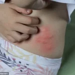UK Experts Warn of Flea Surge Amid Warm Weather, Infestations Possible Even Without Pets