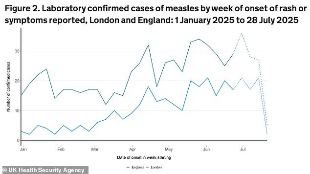 Urgent Call to Vaccinate Children During Summer Holidays as Measles Cases Surge, UKHSA Warns of Potential Public Health Crisis