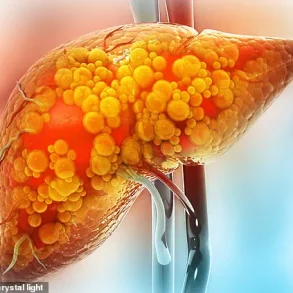 Urgent Warning: Active Lifestyle Doesn't Prevent Liver Disease, as 36-Year-Old Finance Pro Discovers